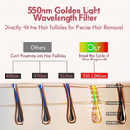 Diagram of 550nm Golden Light Wavelength Filter for Gloreine IPL Hair Removal Device with labeled parts and text.