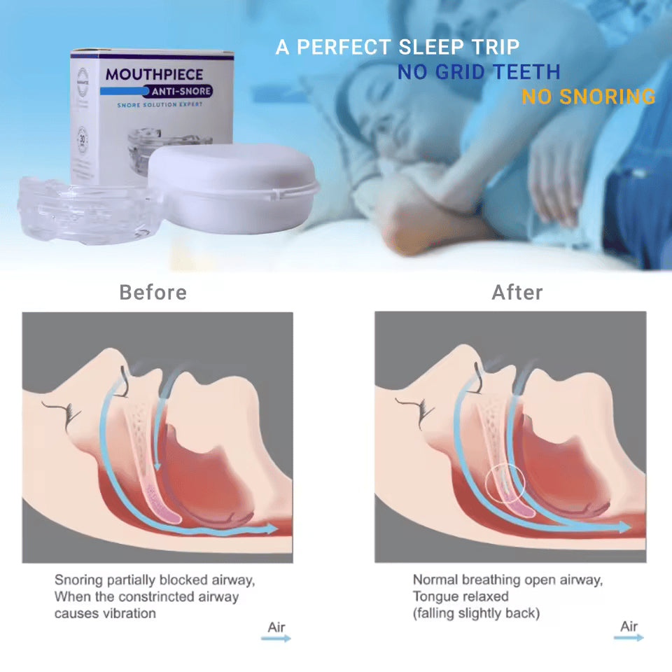 Lullyzee Anti Snore Mouthpiece for anti-snoring with packaging, showing before and after effects on breathing.