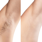 Comparison of hairy and shaved leg on a white background