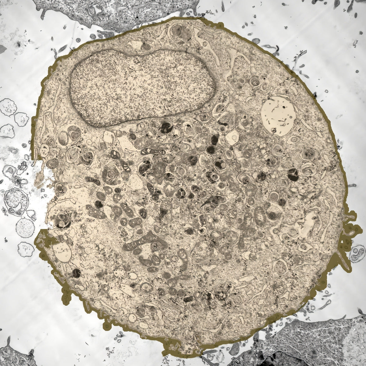 Fenzora Microscope view of cells