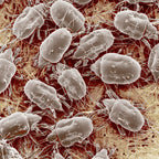 Fenzora Microscope view of microorganisms