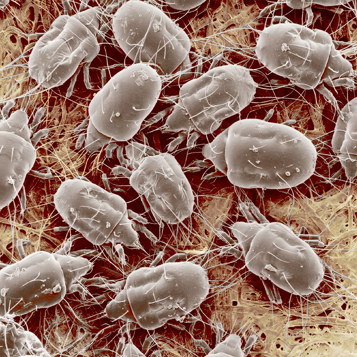 Fenzora Microscope view of microorganisms