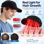 Side view of the HariLumex LED Cap red light hair growth device