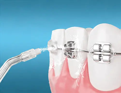 Noventrixa 5-Mode Sonic Toothbrush & Water Flosser Combo charging detail