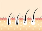 Noventrixa IPL Hair Removal AS20 treatment schedule for weeks three and four